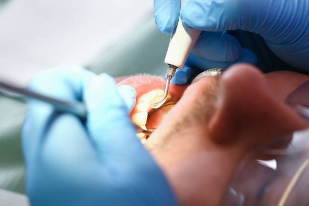 Best Emergency Dental Care for Trauma or Injury in Laguna Vista, TX
